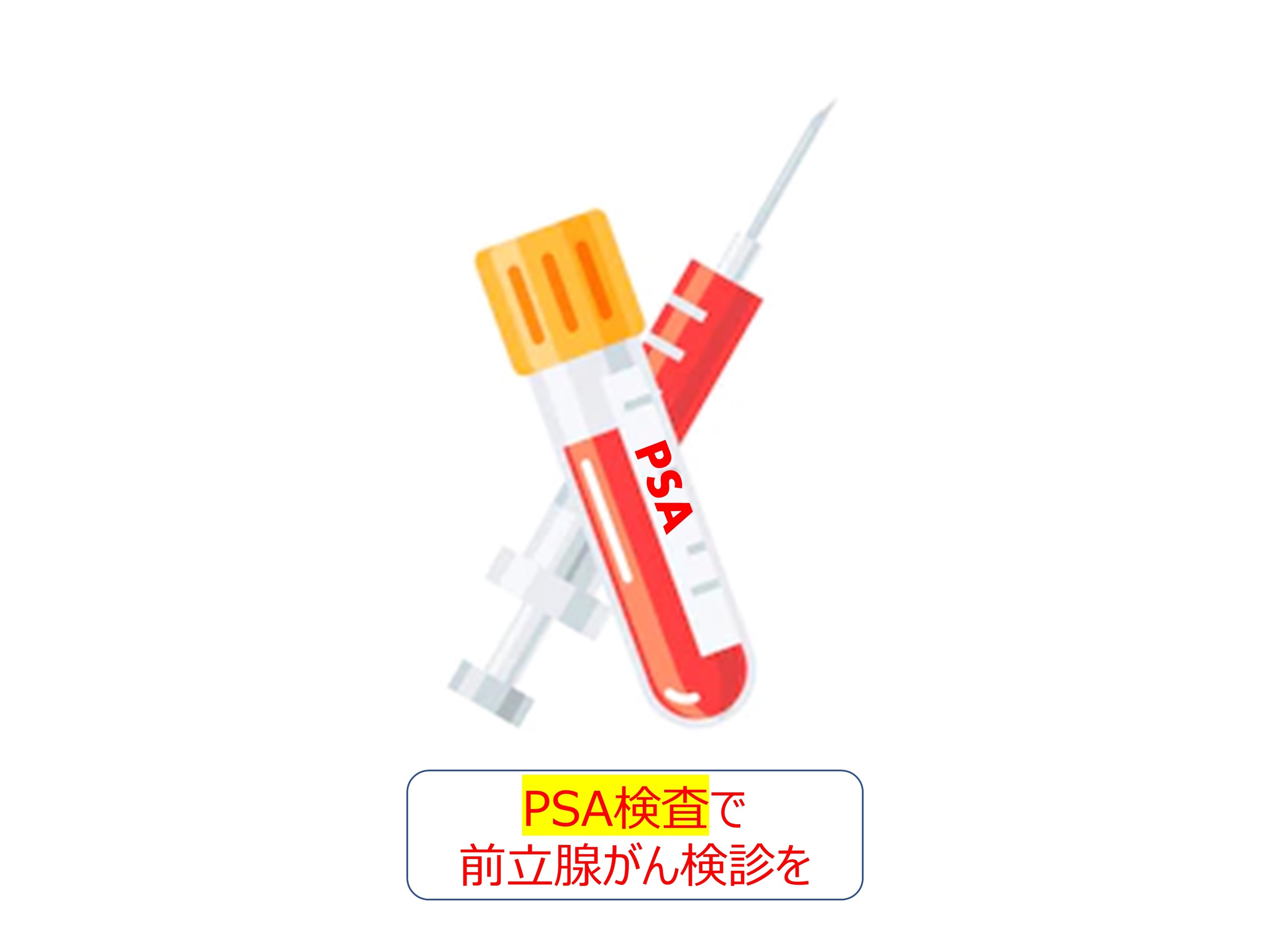 PSA検査で前立腺がん検診を